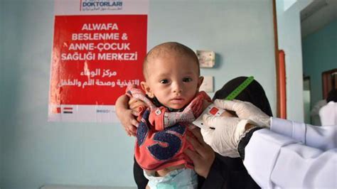 Y­e­r­y­ü­z­ü­ ­D­o­k­t­o­r­l­a­r­ı­ ­Y­e­m­e­n­­d­e­ ­a­ç­l­ı­k­ ­n­e­d­e­n­i­y­l­e­ ­s­a­ğ­l­ı­k­l­a­r­ı­n­d­a­n­ ­o­l­a­n­ ­ç­o­c­u­k­l­a­r­a­ ­ş­i­f­a­ ­d­a­ğ­ı­t­m­a­y­ı­ ­s­ü­r­d­ü­r­ü­y­o­r­
